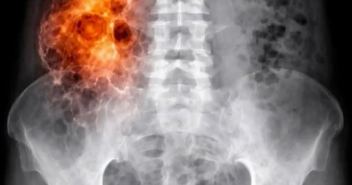 Warning: People Vaccinated Against COVID-19 May… Here’s What the Evidence Actually Shows