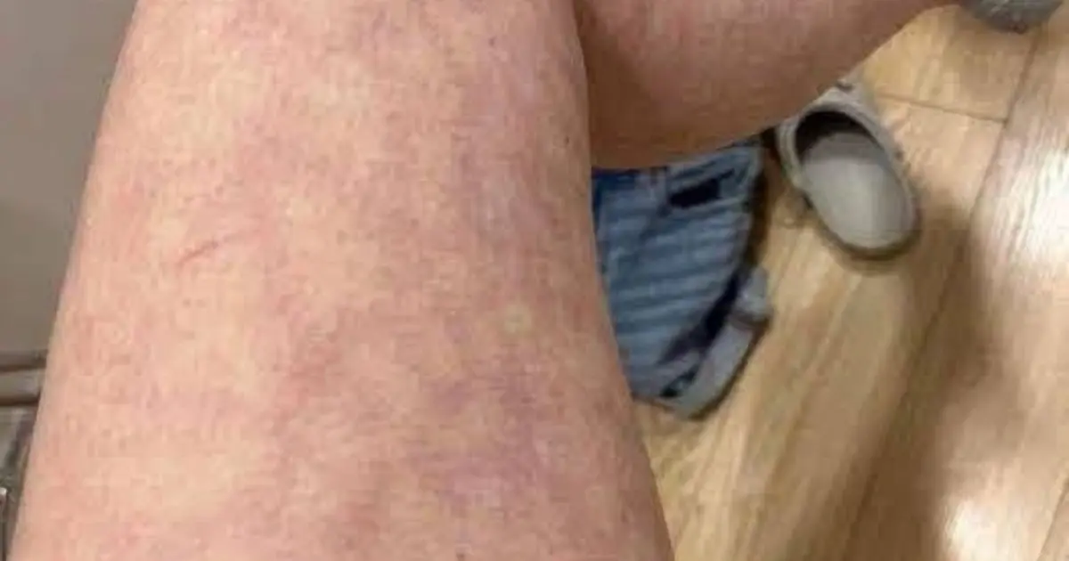 These are the consequences of sleeping with the... See more