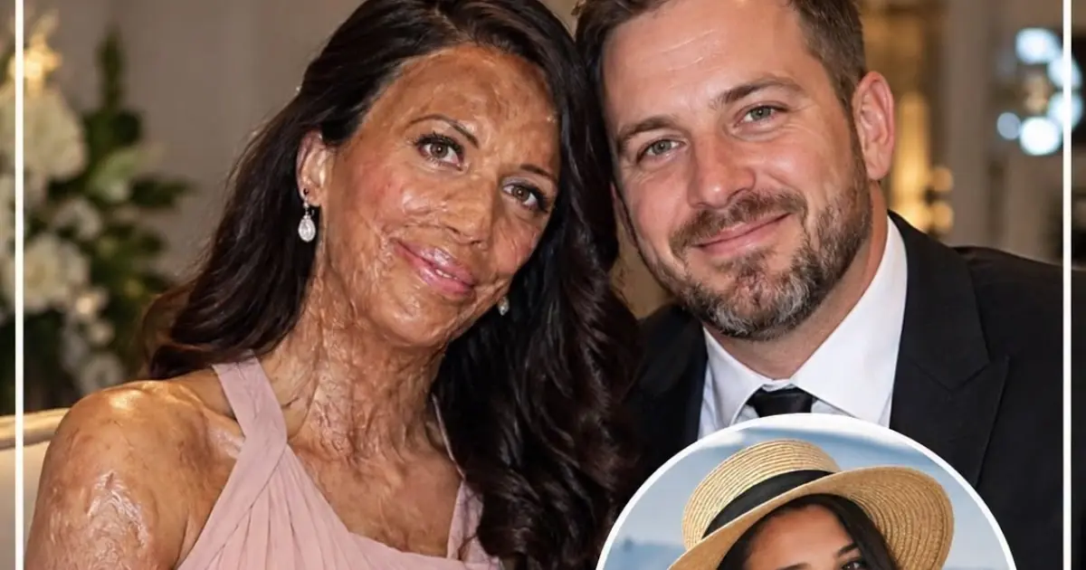 Their love survived the unimaginable—discover the powerful story behind Turia Pitt and Michael Hoskin in the comments