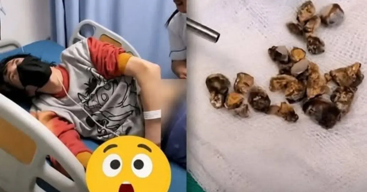 Man hospitalized after a highly unusual medical incident… See more
