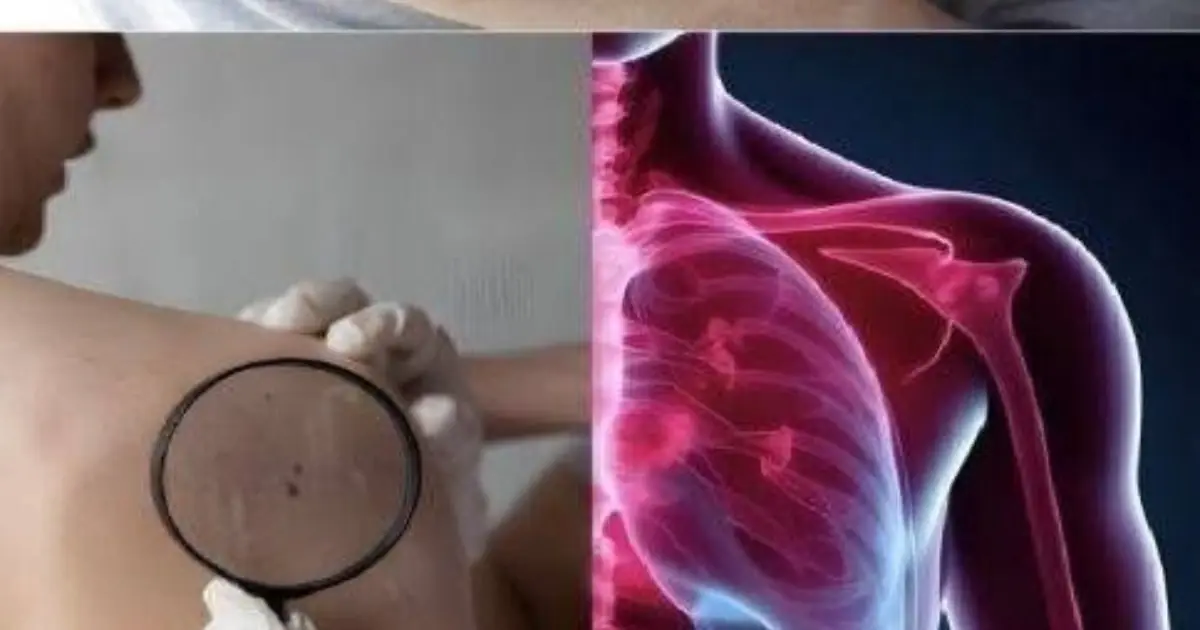 15 Early Signs Can.cer Is Growing in Your Body \