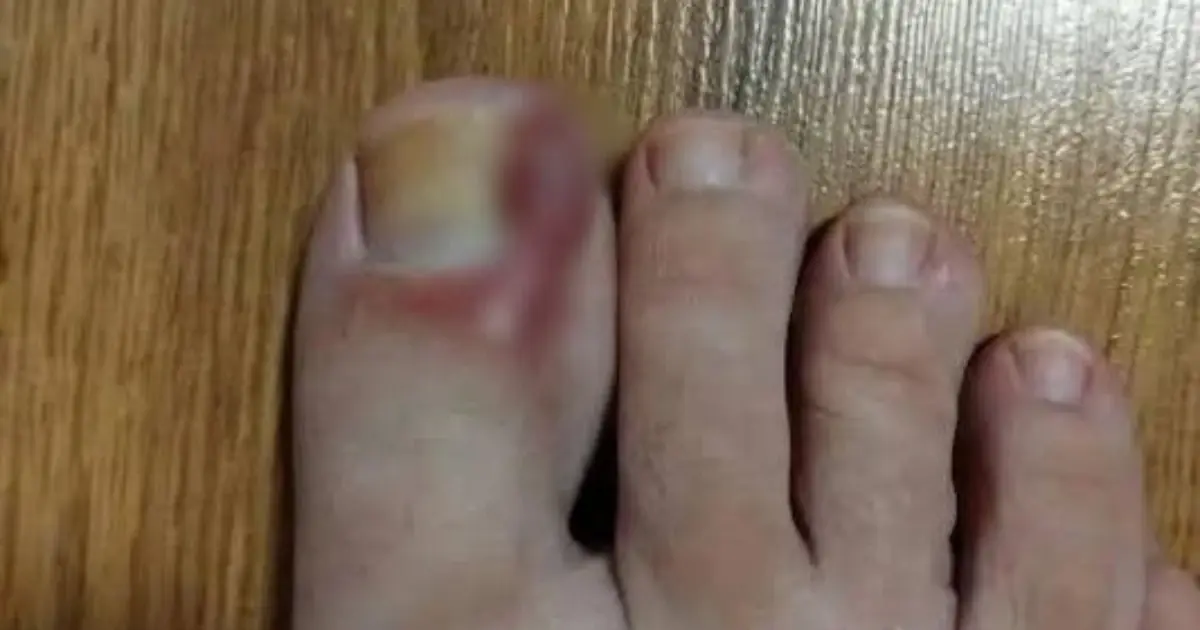 Signs on your FEET that indicate you are cr...See more