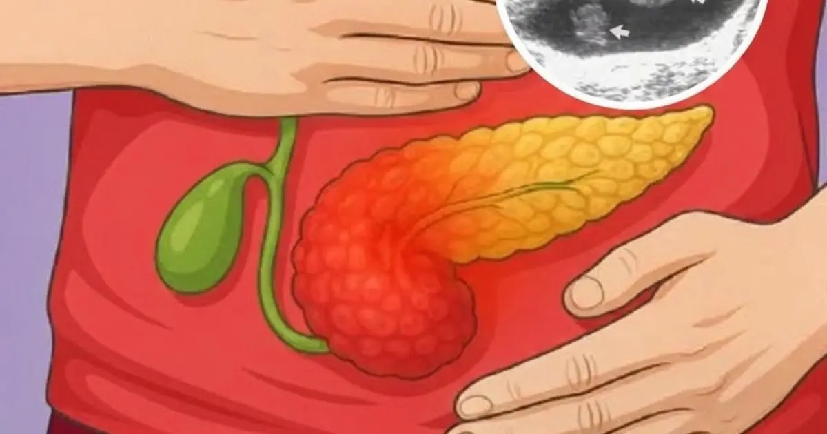 Millions Experience These Symptoms Without Knowing Their Gallbladder May Be Involved