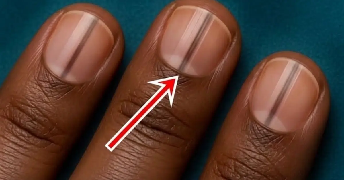 After 40, Your Nails Could Reveal More About Your Health Than You Expect