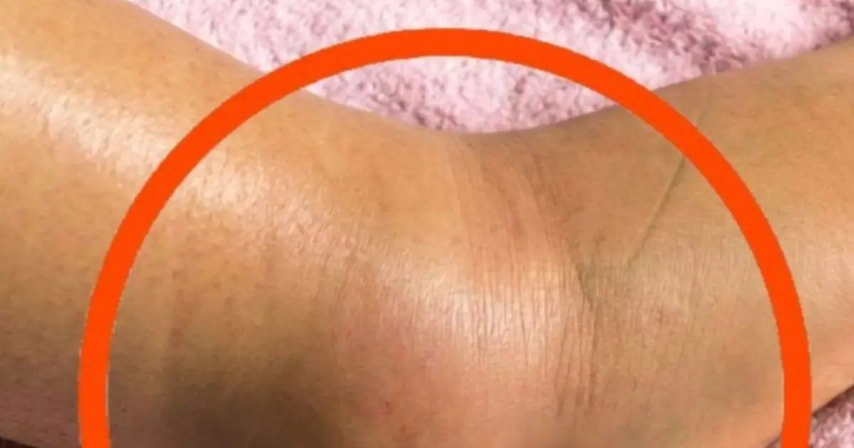 If you notice your legs are swollen, that’s a sign of ca…