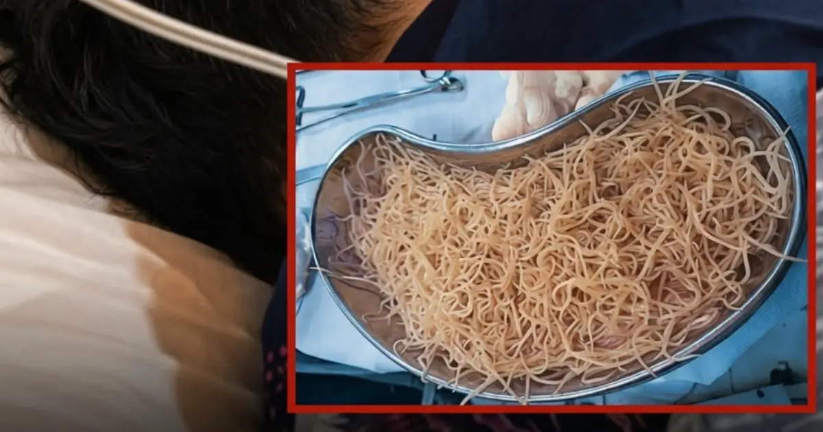 Boy Vomited for Three Days Straight — Doctors Were Shocked by What They Found