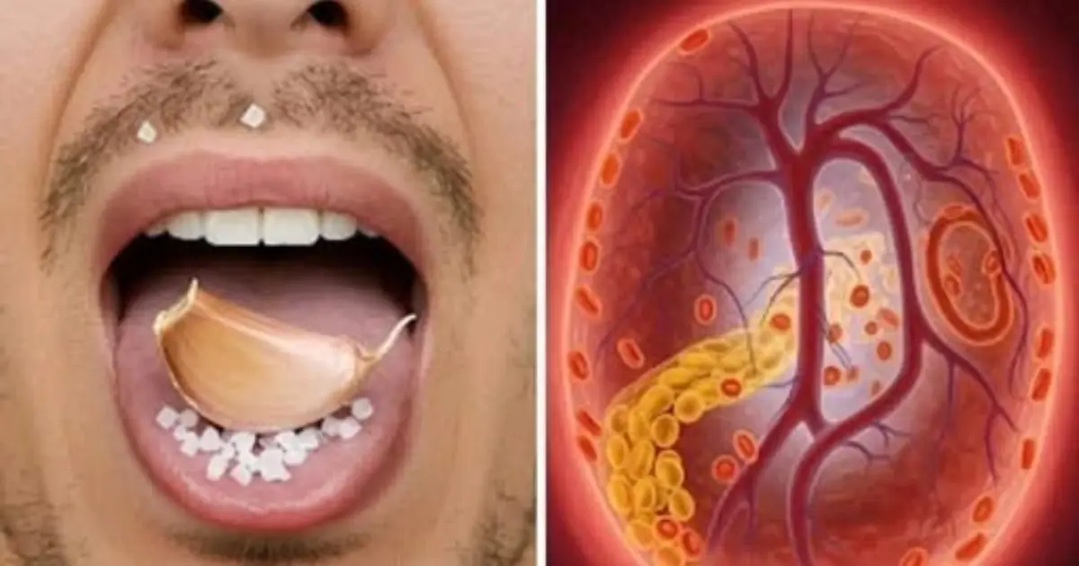 Why So Many People Eat Raw Garlic for Health Benefits