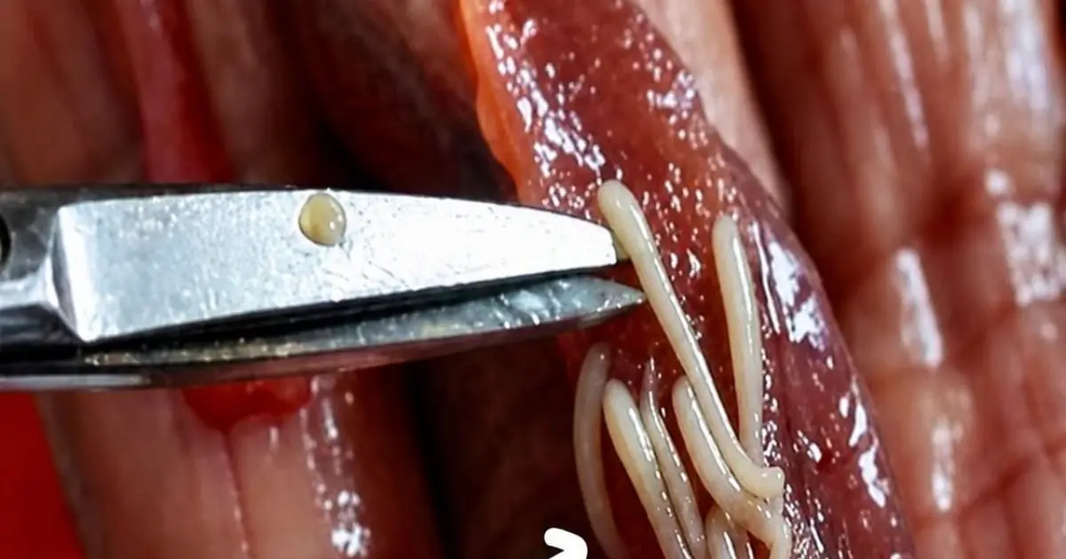 5 popular and delicious foods loved by many but also favorites of parasites
