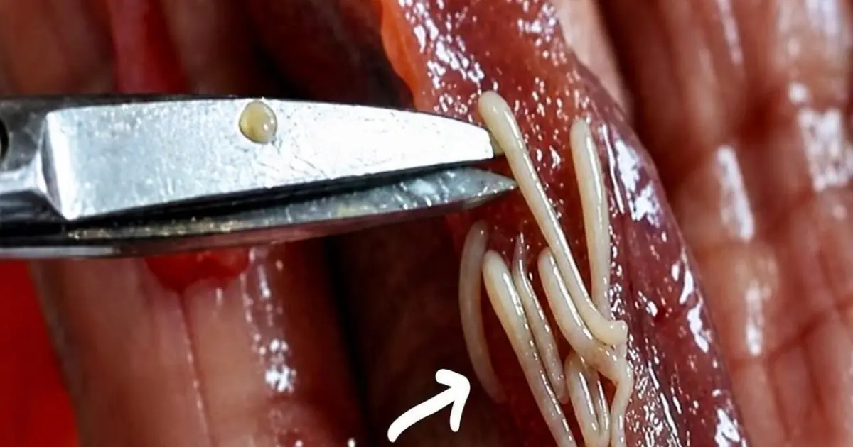 5 popular and delicious foods loved by many but also favorites of parasites