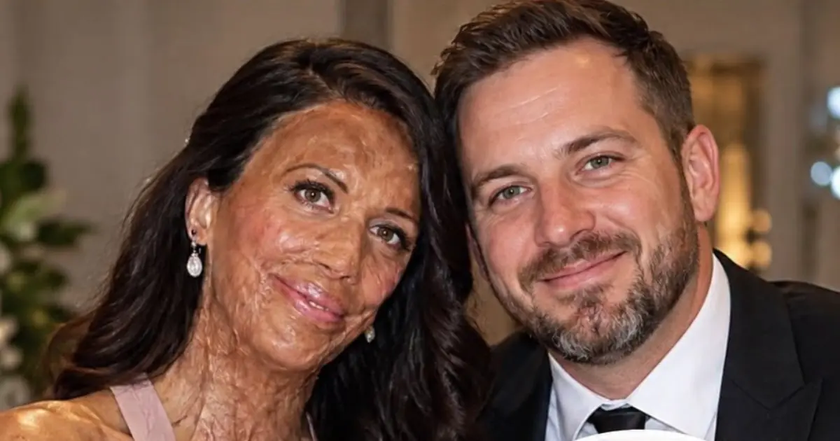 “Her Appearance Changed, But My Love Never Did”: The Remarkable Story of Turia Pitt and Michael Hoskin
