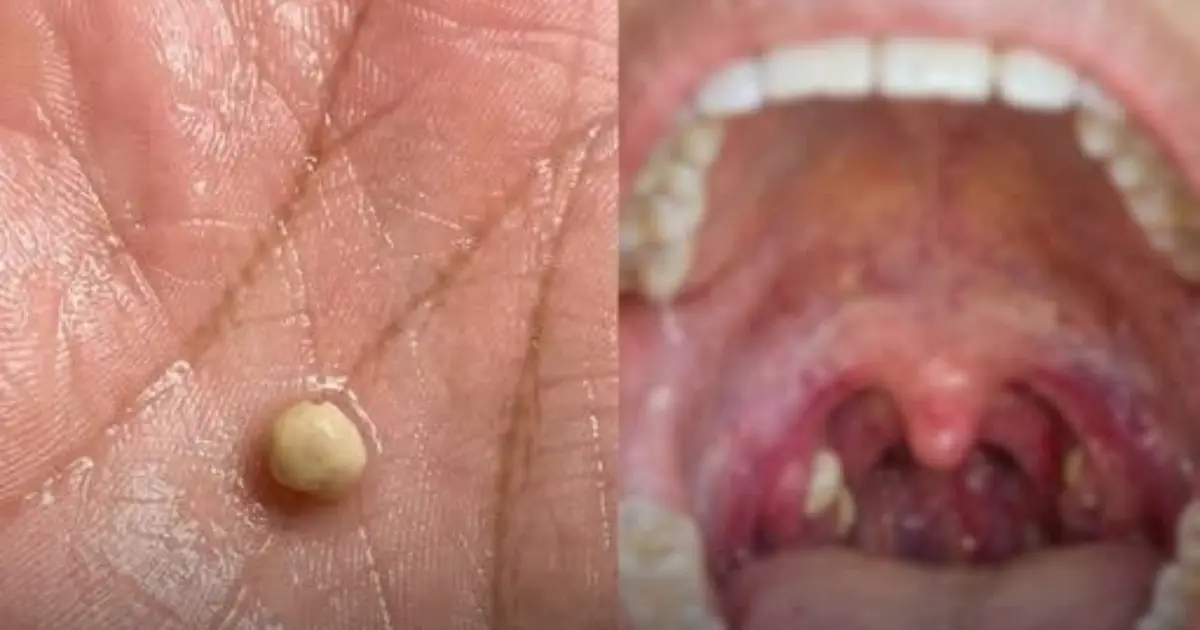 Suddenly Feeling Something Stuck in Your Throat?