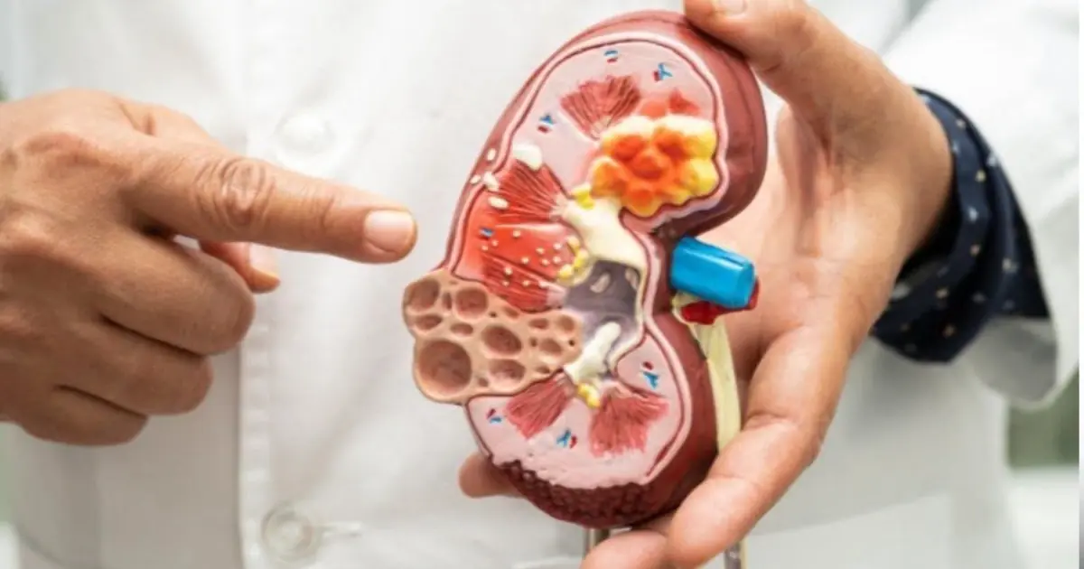 1 minute to “check your kidneys” at home