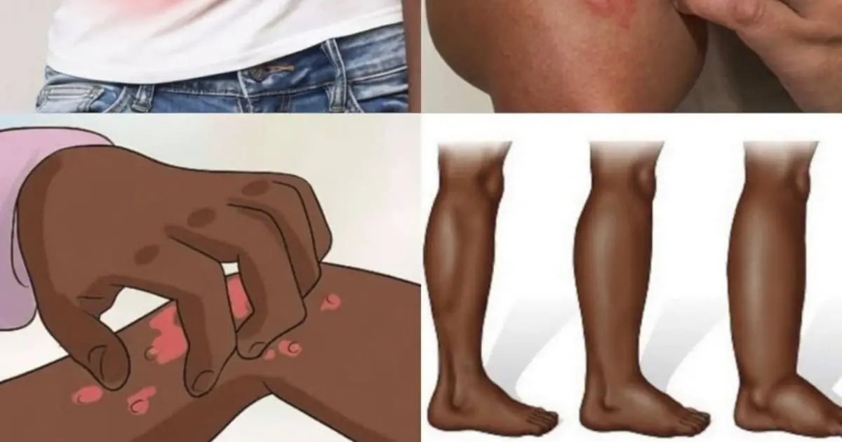 Pay Attention to These 8 Signs That May Be Linked to Kidney Health