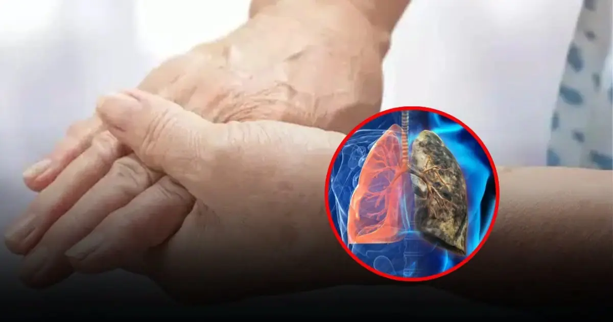 Your body often whispers before it screams. Unusual signs in your fingers may be worth paying attention to