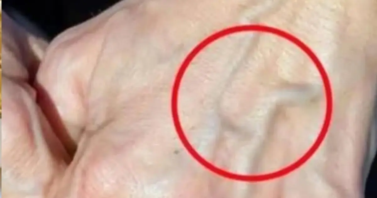 If you have visible veins it means you are... see more