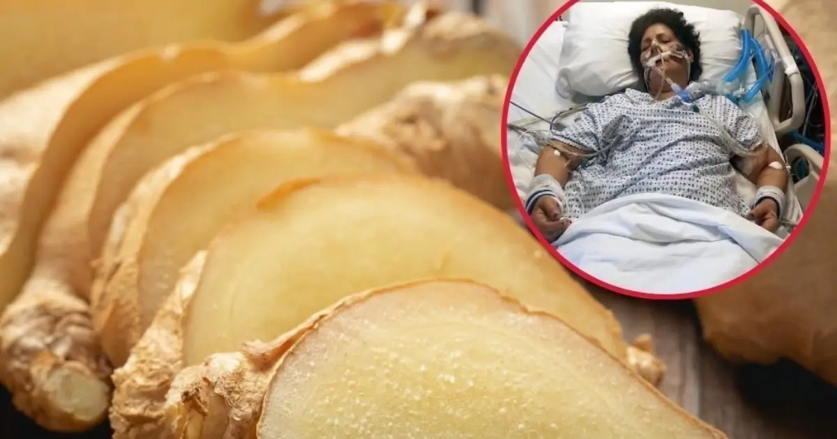 54-Year-Old Woman Thought Ginger Was Healthy Ate It Daily for 3 Months and Paid a Painful Price