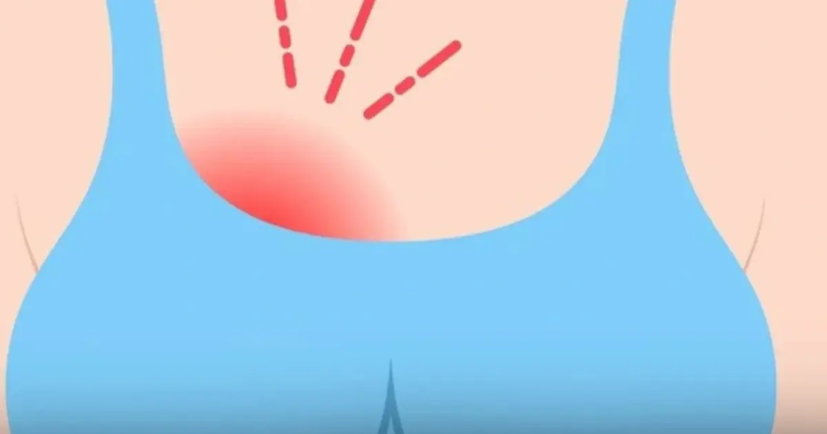 Early Bre:ast Can:cer Symptoms That Often Go Unnoticed — What Doctors Want You to Know