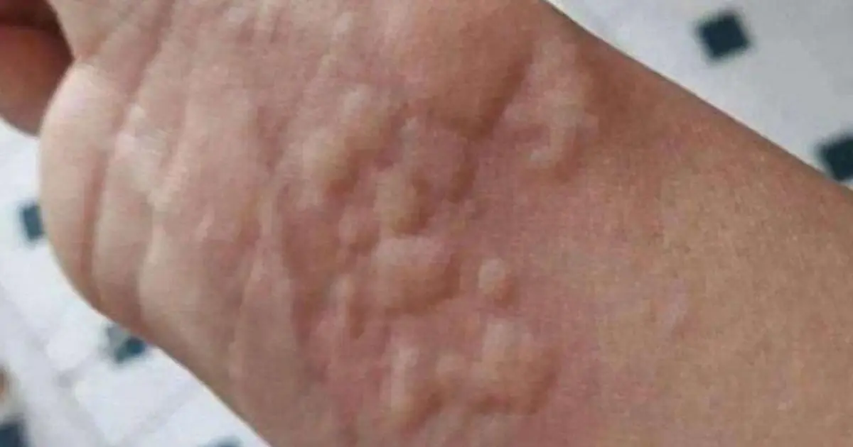 These are the consequences of sleeping with… See more in 1st comment 👇