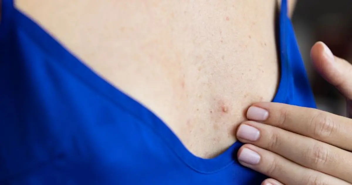 Could These Bre.ast Changes Mean Something More? 8 Signs to Know
