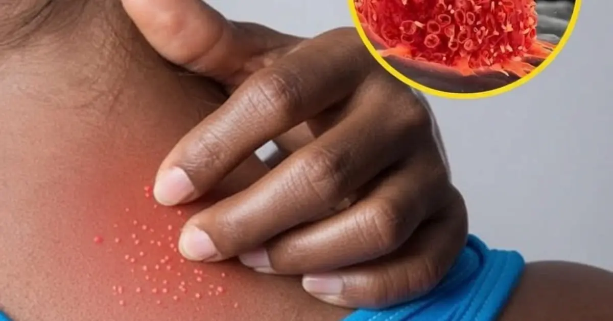 These 9 Types of Persistent Itching May Be Warning Signs of Serious Health Problems - Including Can.cer
