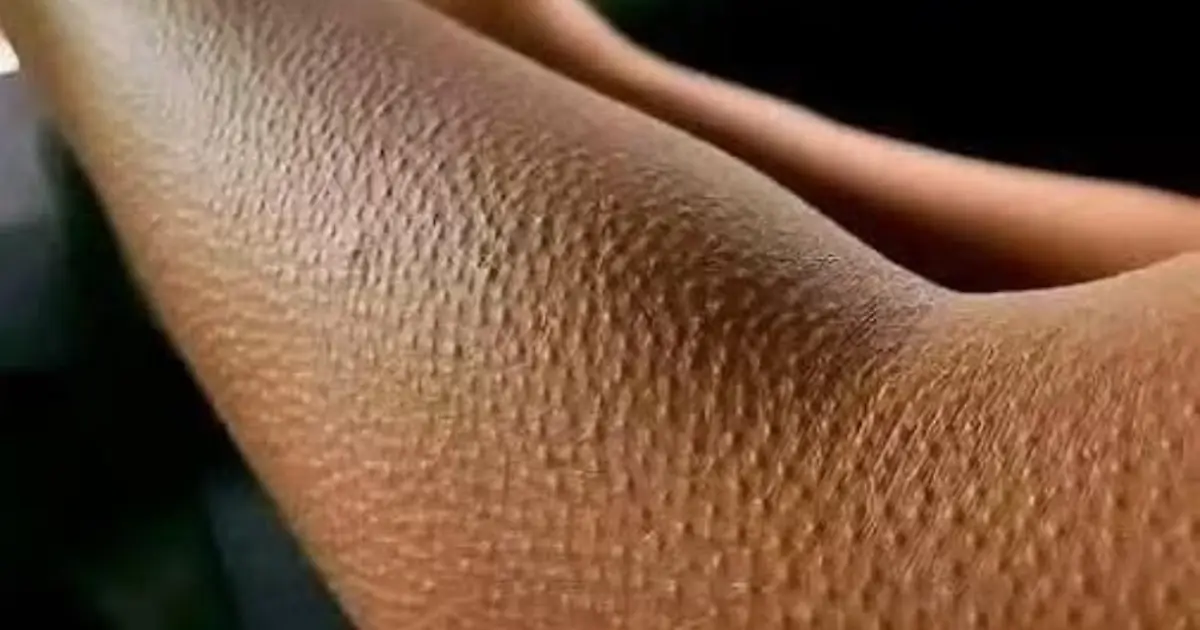 If Your Skin Looks Like This, Here’s What It Really Means