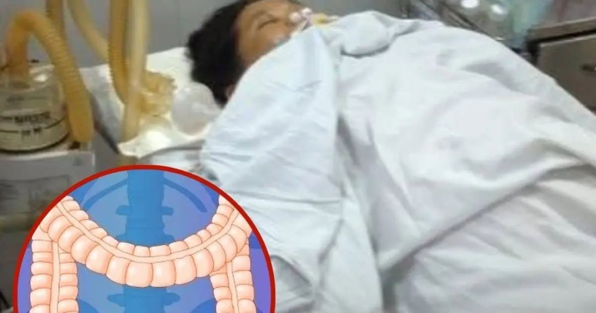Young Engineer Diagnosed With Stage 3 Colon Can.cer at 25 After Ignoring One Warning Sign