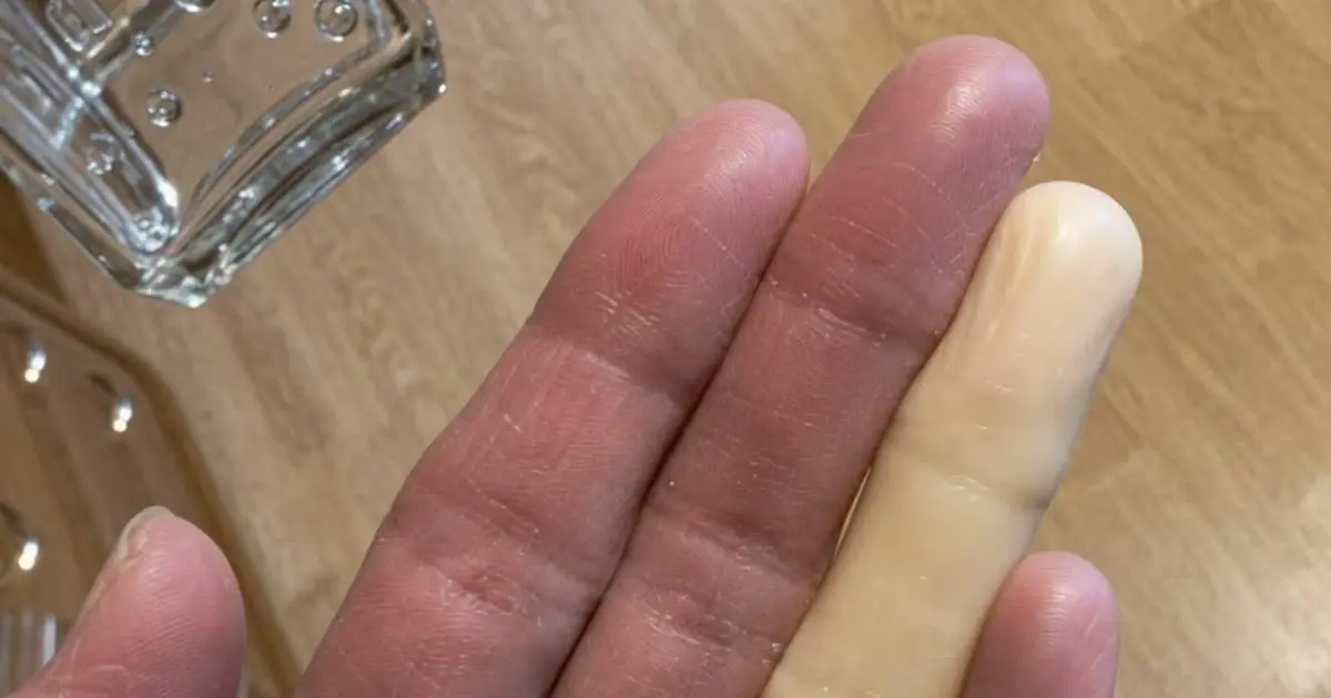 The Midnight Chill: Why You Might Wake Up with a Pale, Numb Finger (And How to Gently Restore Warmth and Circulation)