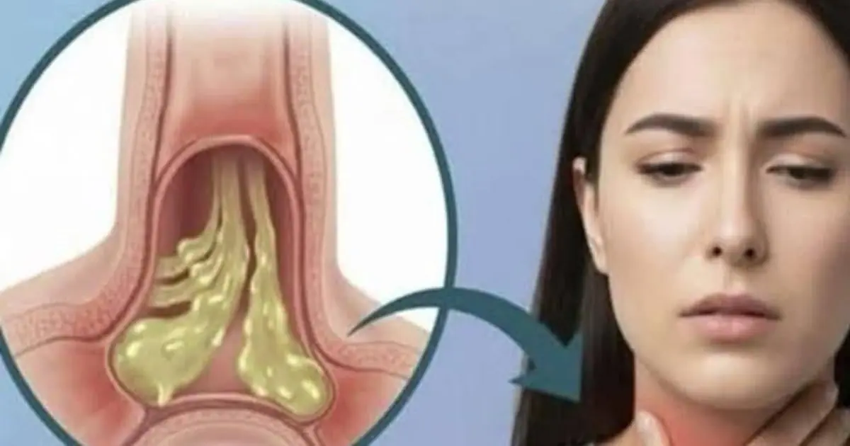 Constant phlegm in your throat and you don't know why...