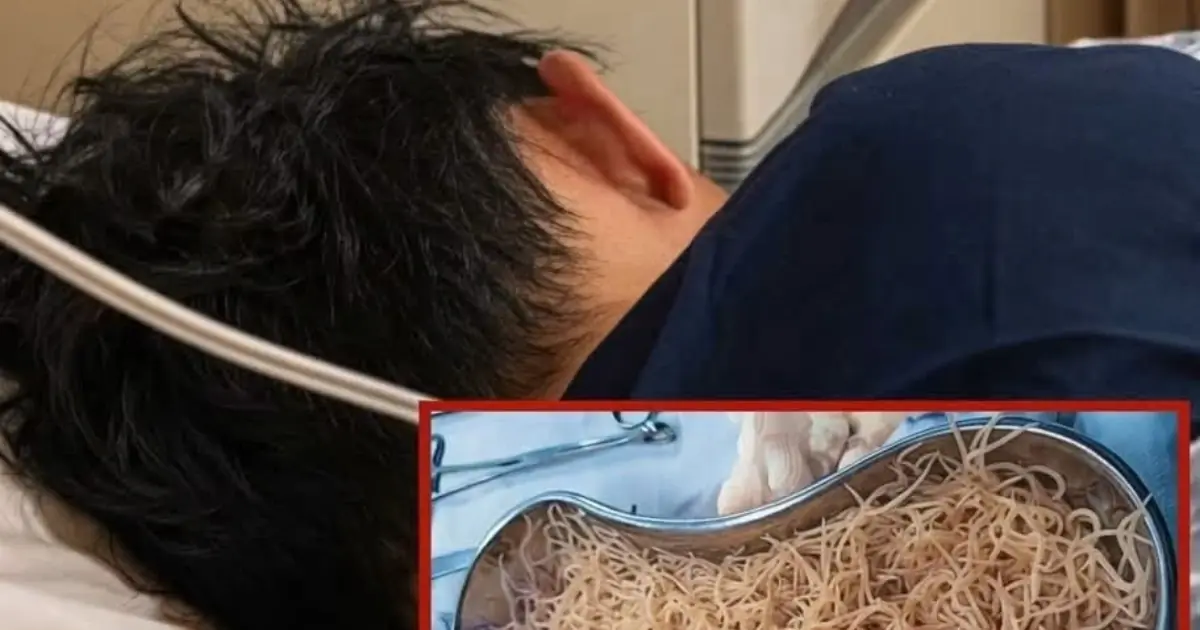 Doctors Were Sho.cked By What They Found Inside His Intestines…