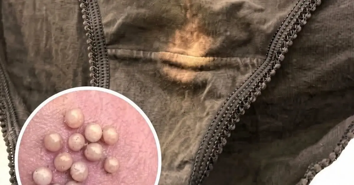 That Unusual Stain Isn’t Always Normal: What Vaginal Discharge May Be Telling You
