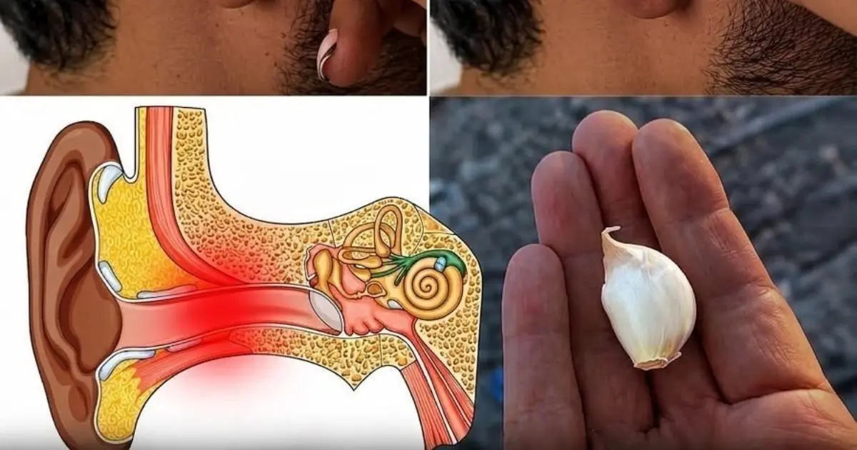 The Garlic Trick Everyone Talks About — Here's What Actually Works