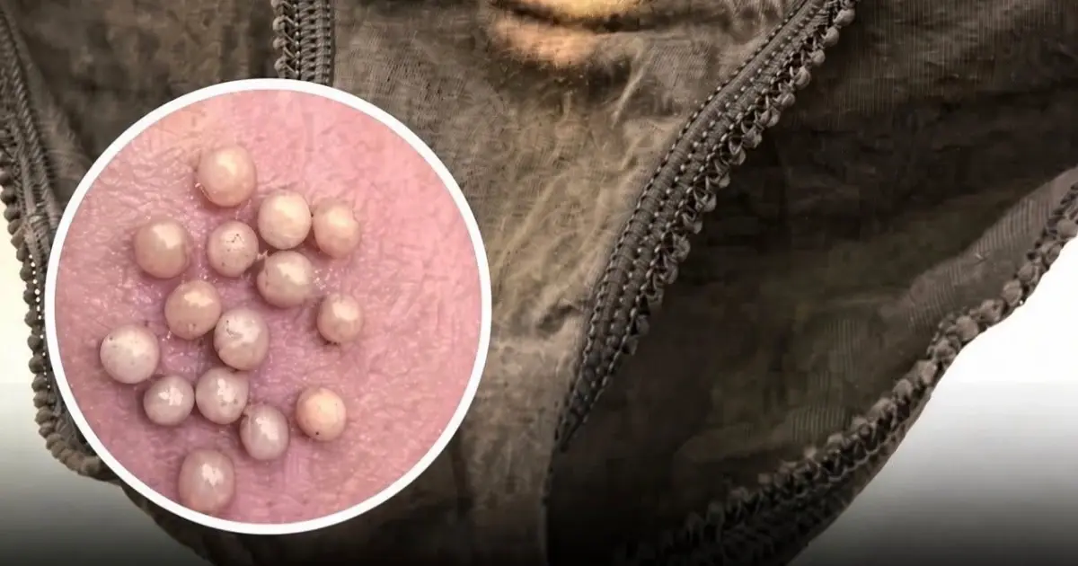 This Stain on Your Underwear Isn’t Normal Discharge. Could Be a Sign of…
