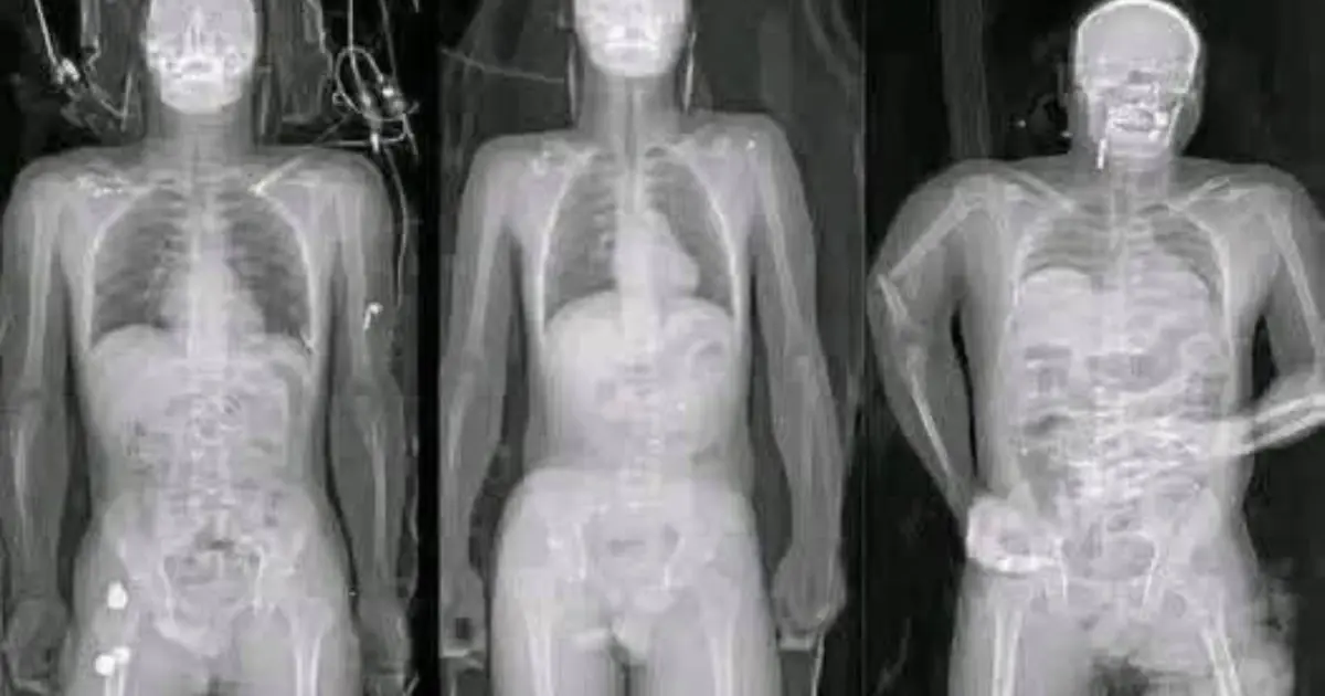COVID 19 vaccinated individuals may be ill...