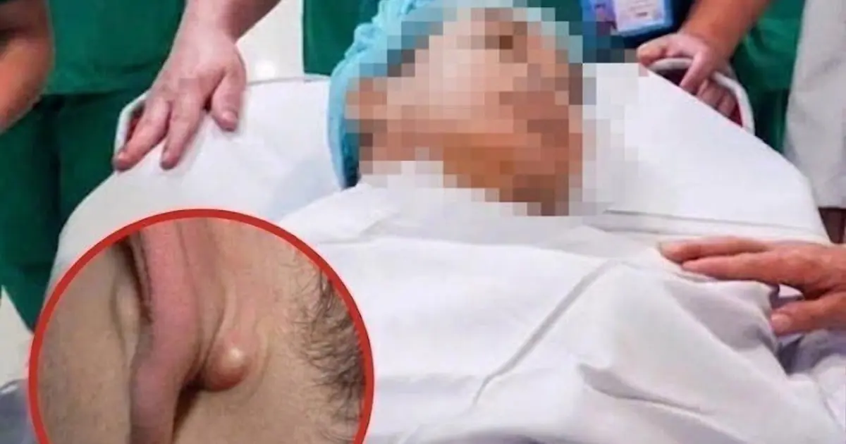 Young Man in His 20s D.i.es of C.anc.er After Ignoring Two Nighttime Symptoms