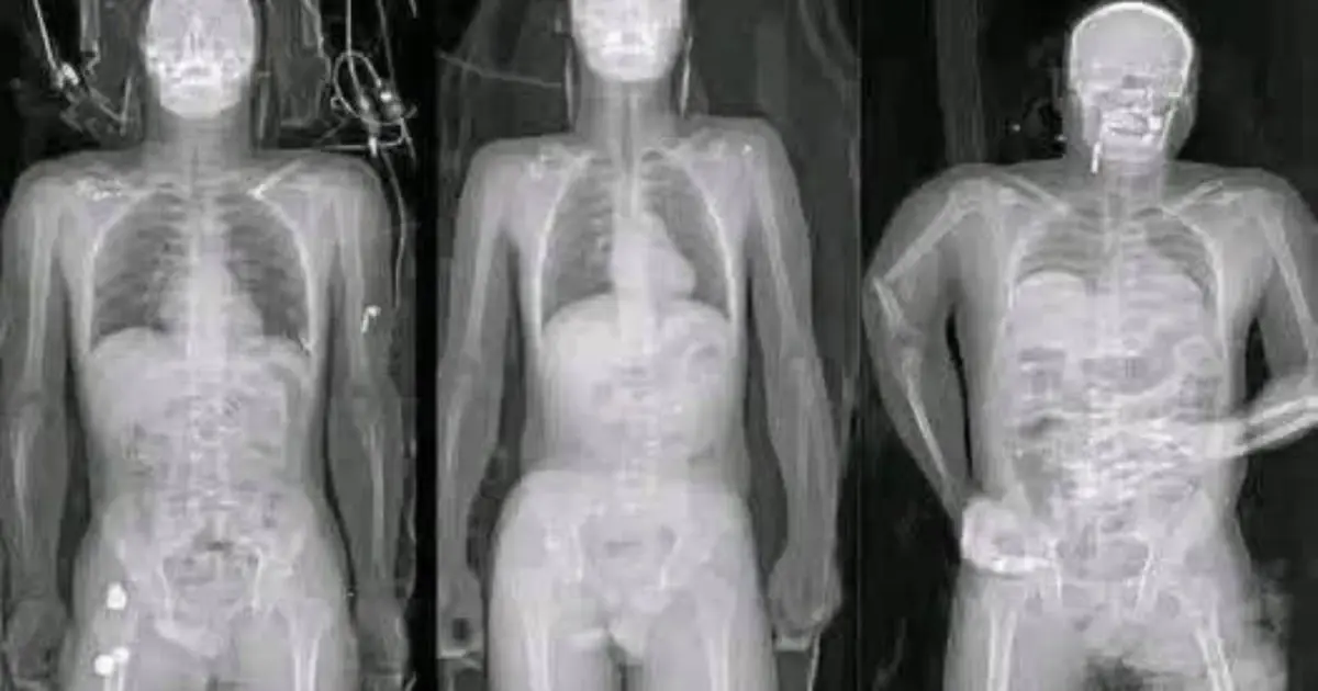 COVID 19 vaccinated individuals may be ill...