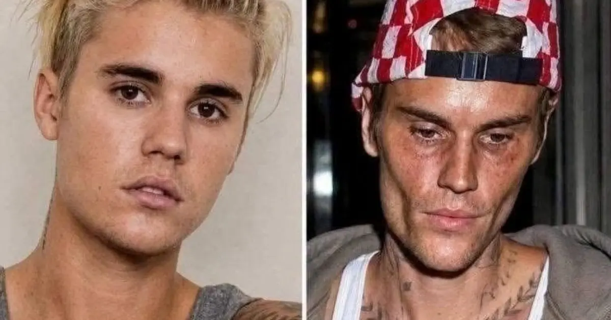 Justin Bieber admits that he tested positive for…See more