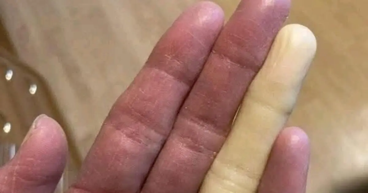 These are the consequences of sleeping with the… See more