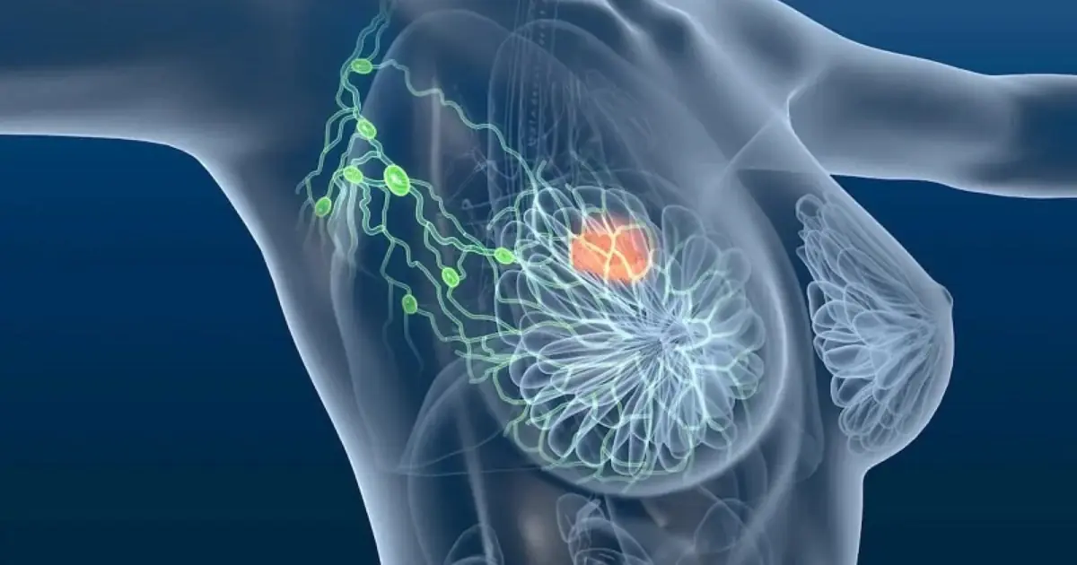 Breast Can.cer Warning Signs: 15 Changes You Shouldn't Ignore