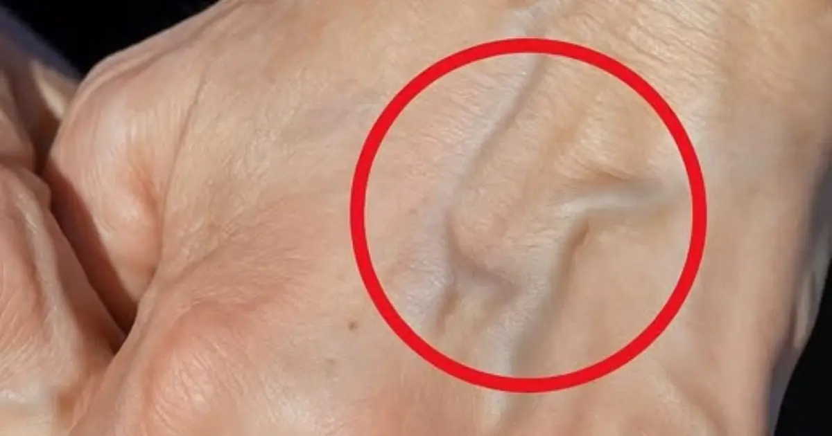 If you have visible veins, it means you are… See more 👇