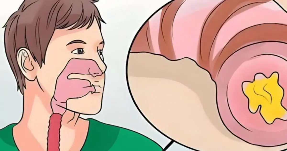 Struggling With Constant Throat Clearing? Try These Doctor-Recommended Tips