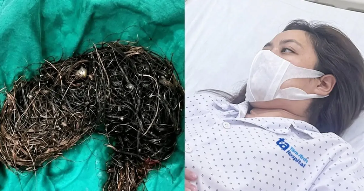 A 14-Year-Old Girl Suffered Stomach Pain for Months—What Doctors Found