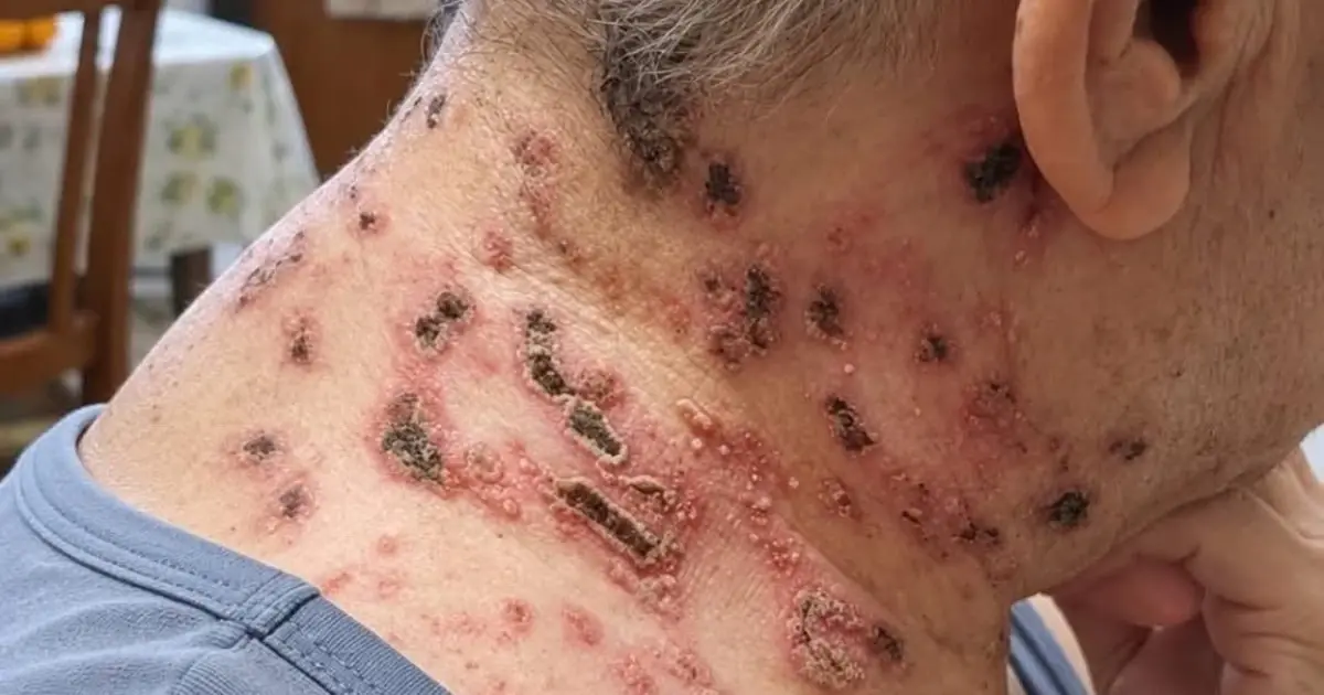 This is the hidden illness that is triggered when you come into contact with...