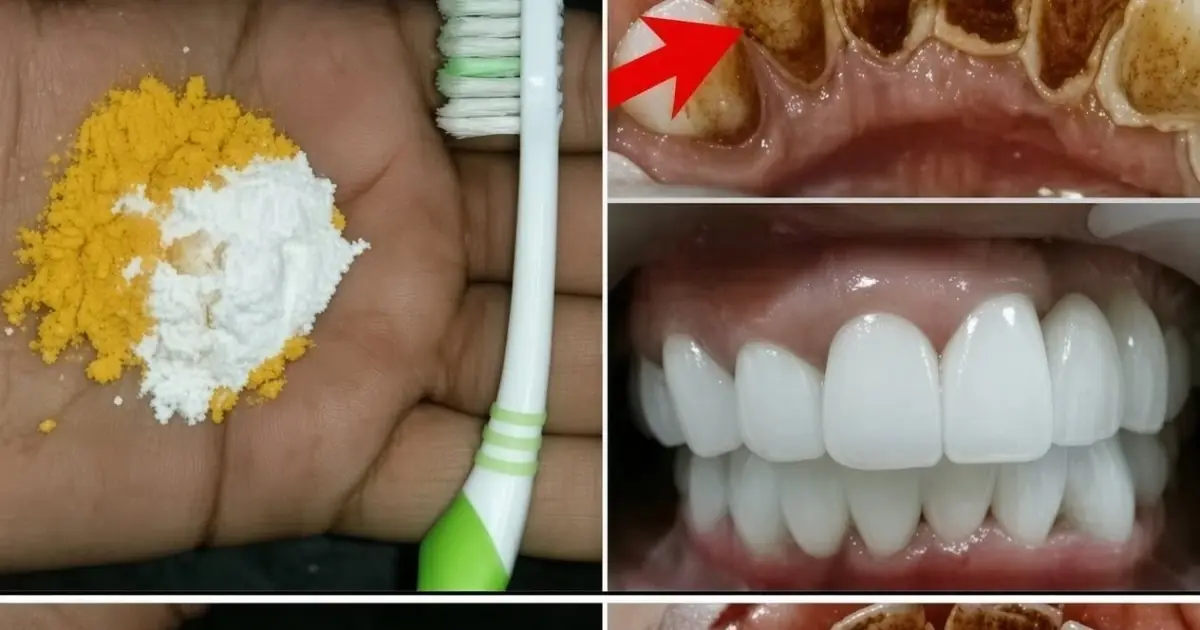 Home Teeth Whitening: Get Whiter Teeth in Just 2 Minutes!