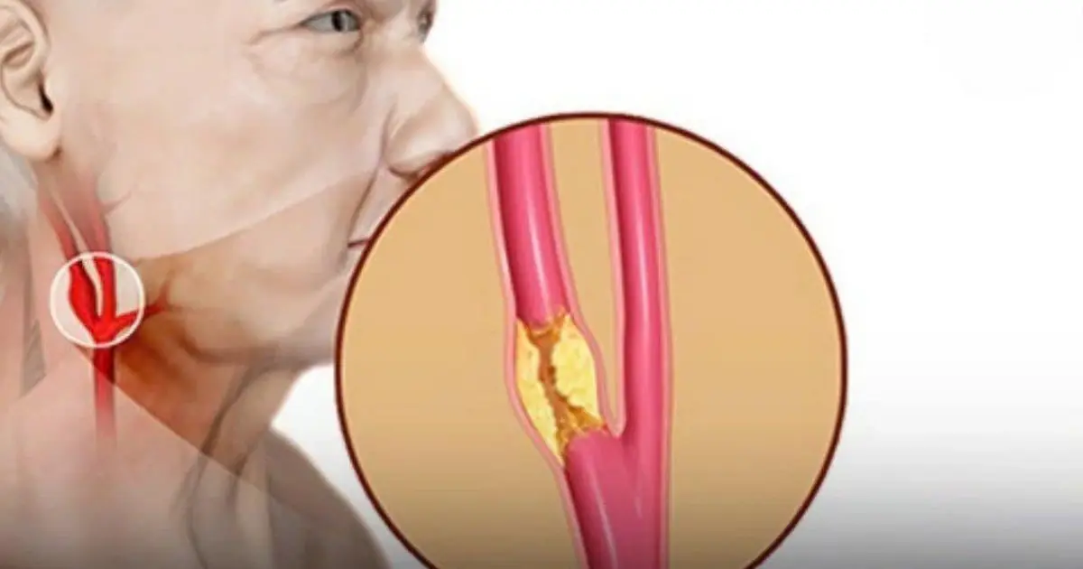 6 Simple but Evidence-Based Ways to Support Heart and Artery Health