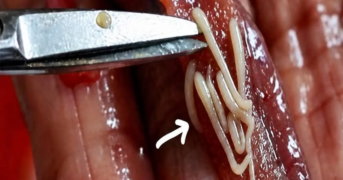 5 Common Foods That May Contain Parasites if Not Properly Prepared