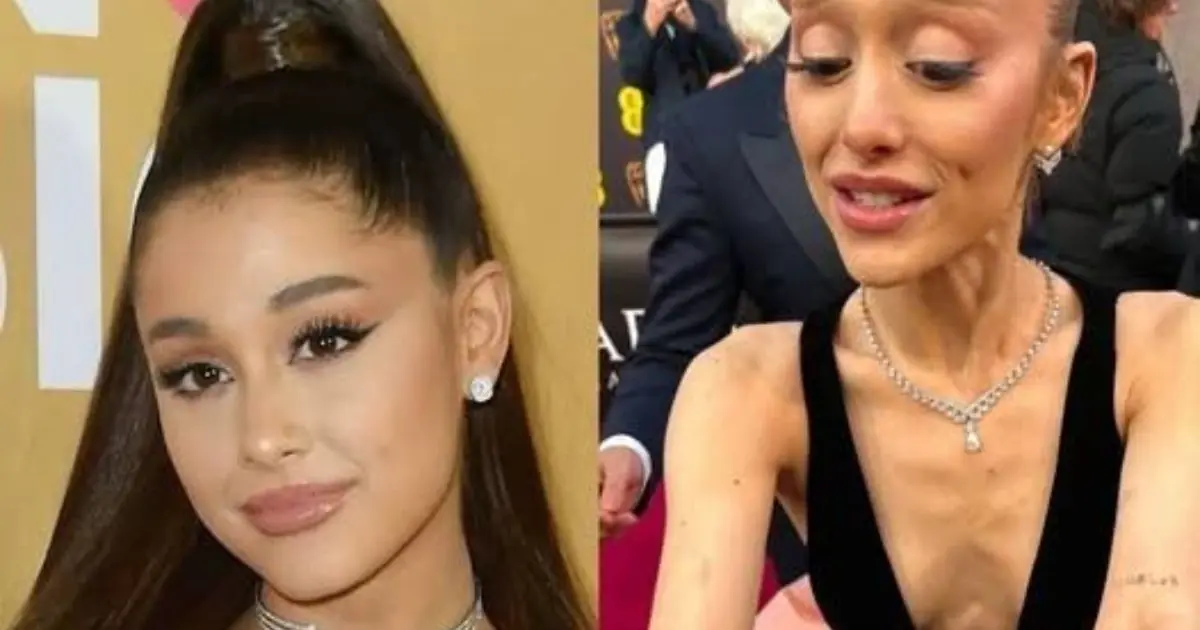 Breaking- Ariana Grande Confirms She Has Tested Positive for…See more