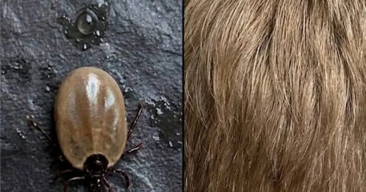 Health Alert for Parents: If You Spot This in Your Child’s Hair, Take a Closer Look