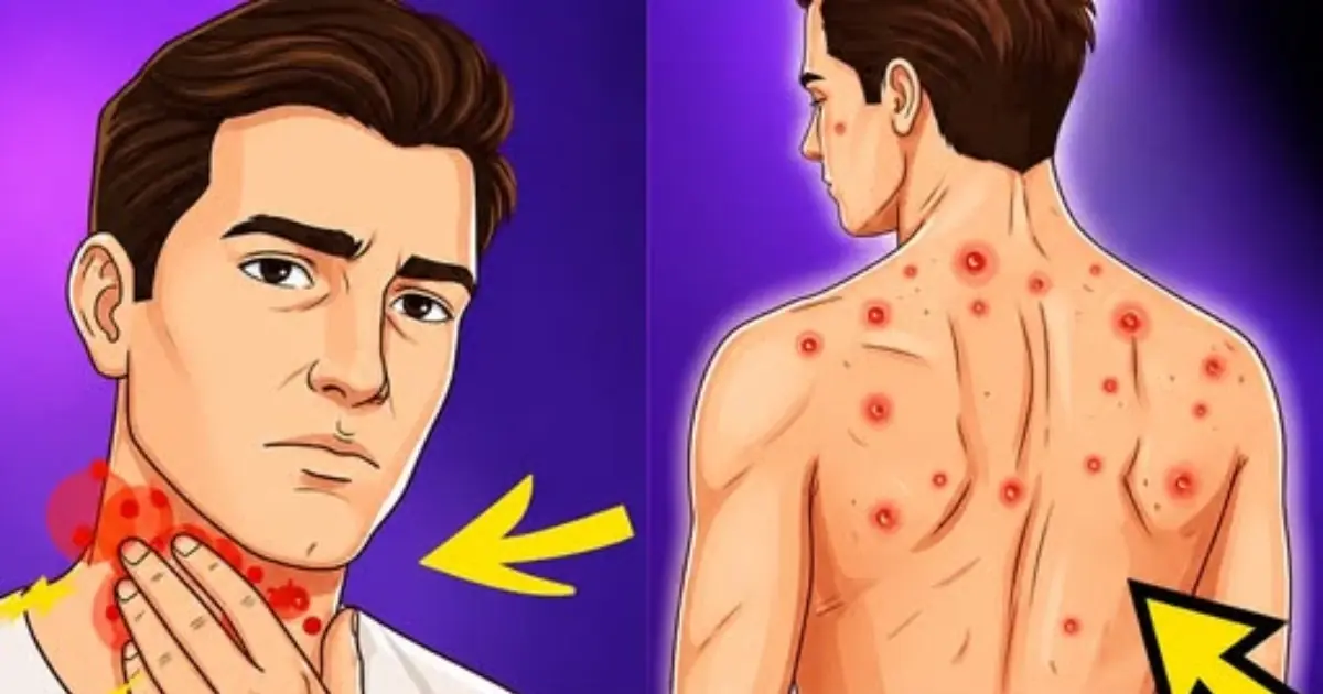 7 Silent Symptoms of Fatty Liver Disease You Should Never Ignore