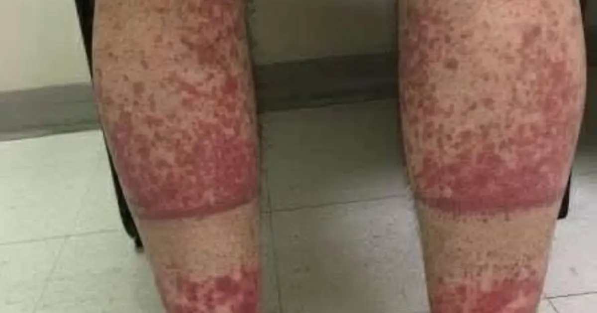 These are the consequences of sleeping with...