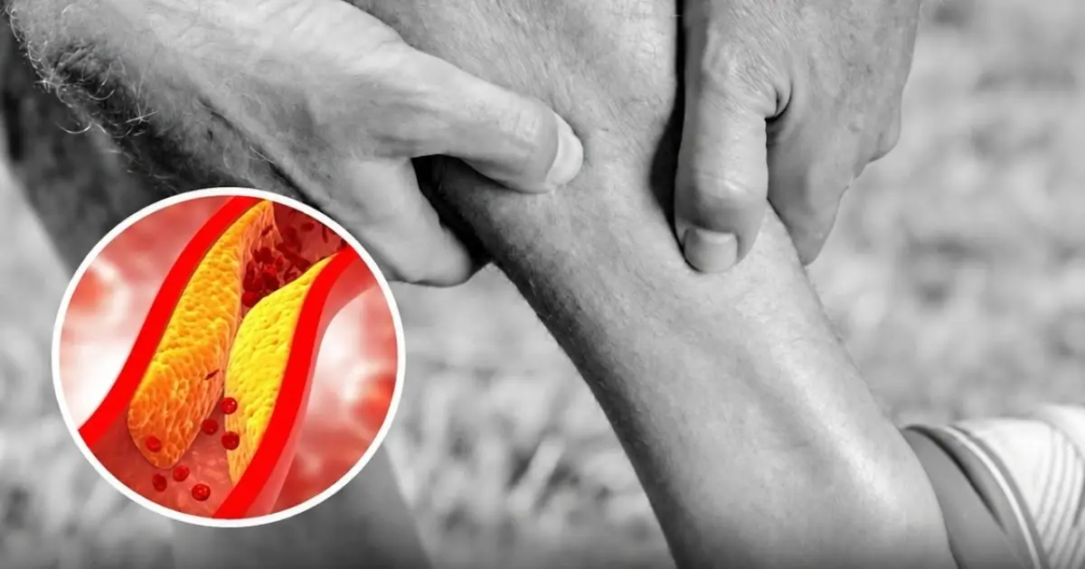 Warning Signs in Your Legs at Night: What They Could Mean for Your Heart Health